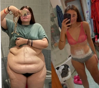 Before and after with Traininpink
