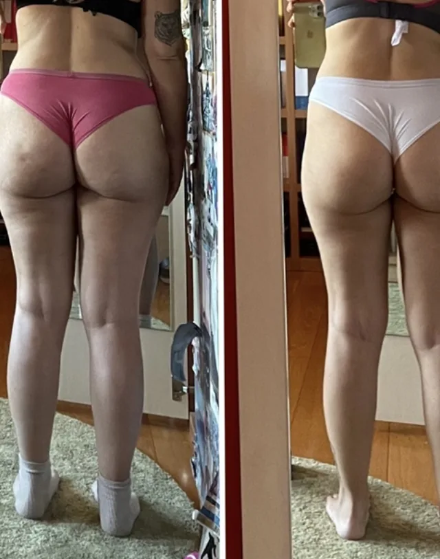 Barbara after lymph-draining Pilates results