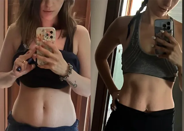 Before-and-after photo of Angela, who lost 7kg with Pilates Linfodrenante